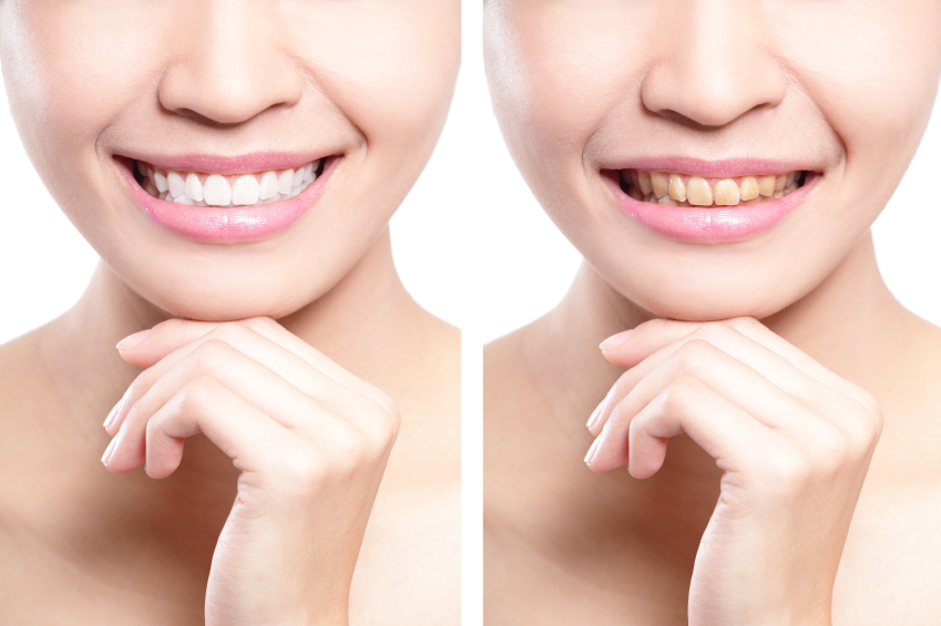 Cosmetic Dentistry