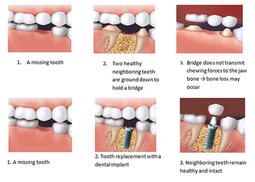 Implantology Khandpur