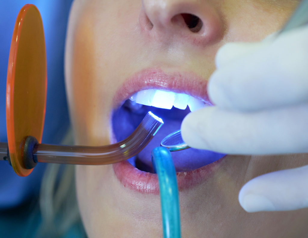 Cosmetic Dentistry