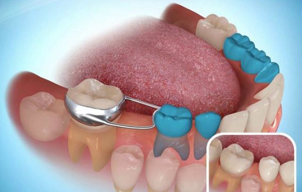 Paediatric Dentistry 