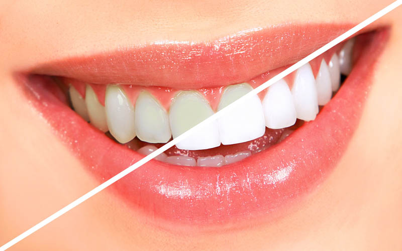 Cosmetic Dentistry